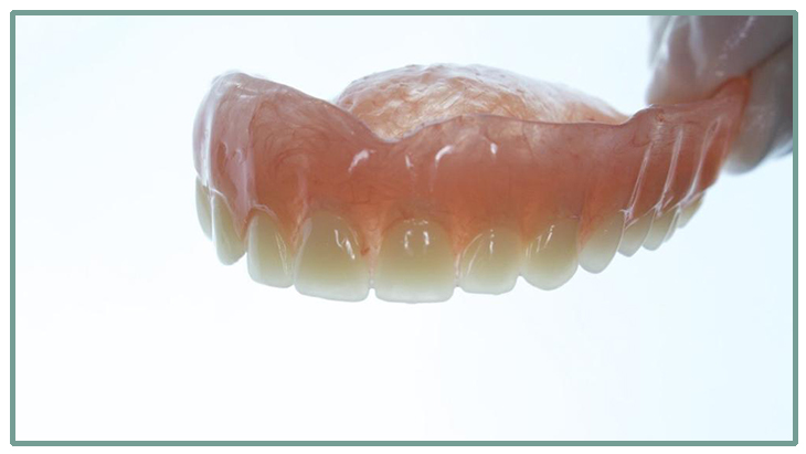 Complete Denture